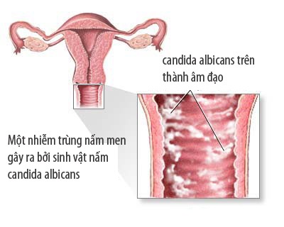 NGUYÊN NHÂN CHỊ EM BỊ RA MÁU TRƯỚC CHU KỲ KINH